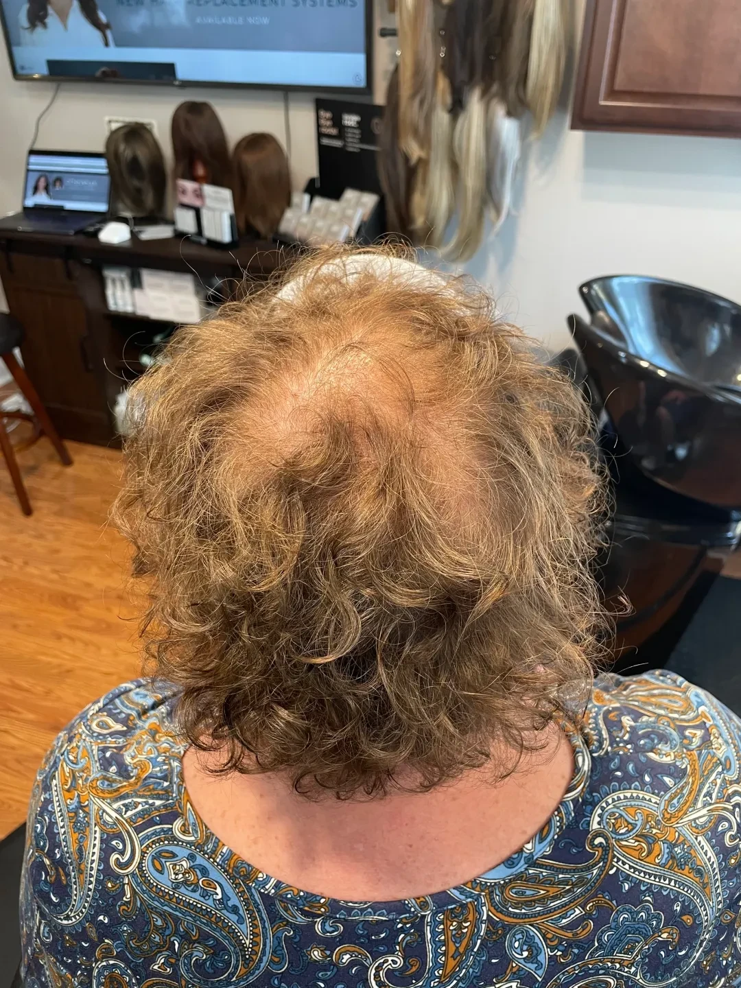 Before — hair before topper consultation